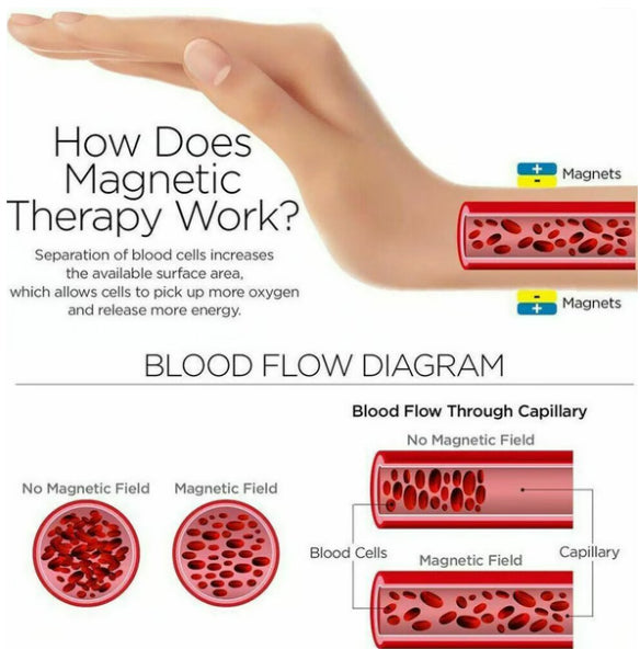 Magnetic Therapy Bracelet